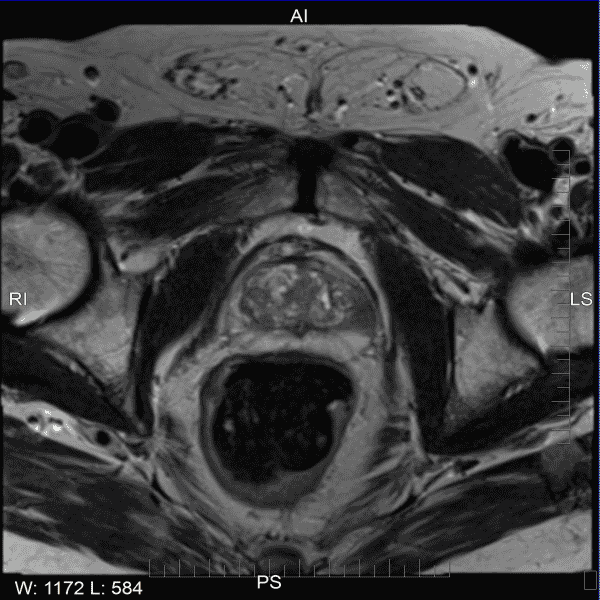 MRI 03-10-2026 Se-4 Img 17 (POS)